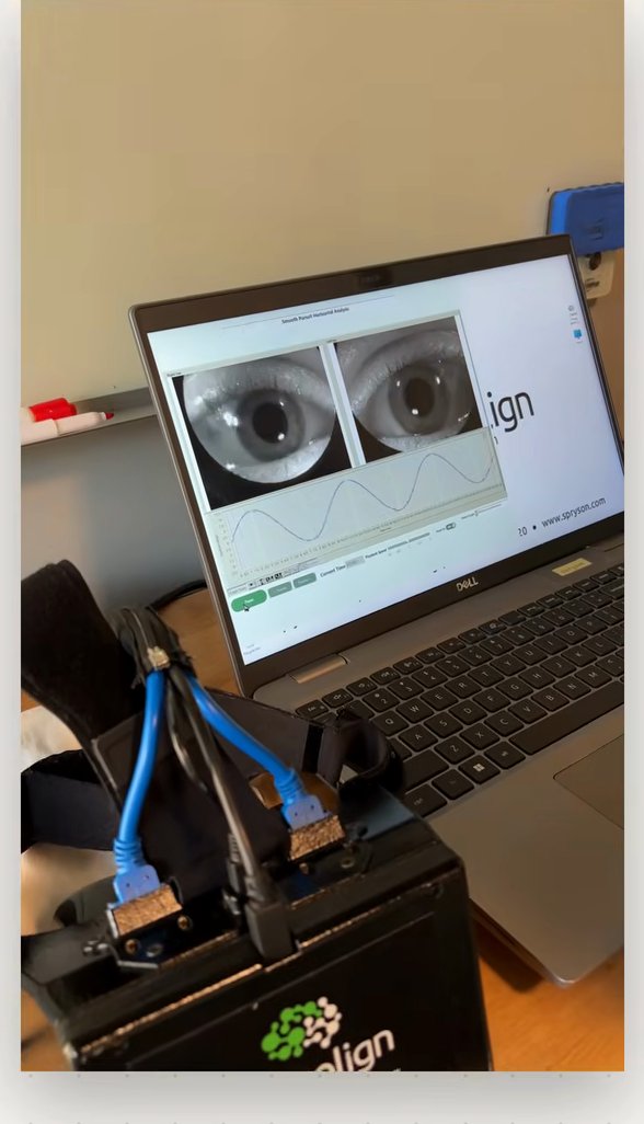 Video-oculography goggles beside a laptop showing live infrared images of both eyes