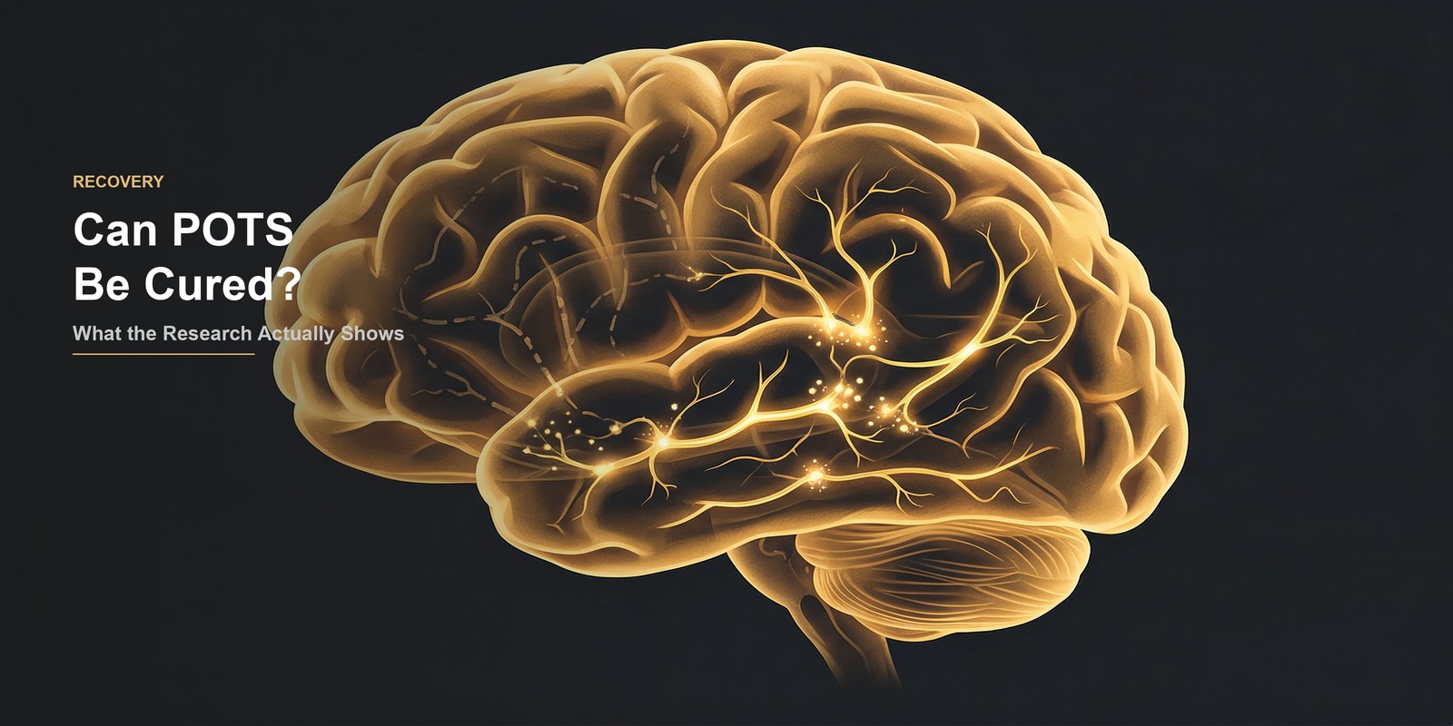 Neural pathways reconnecting — representing POTS recovery through neuroplasticity